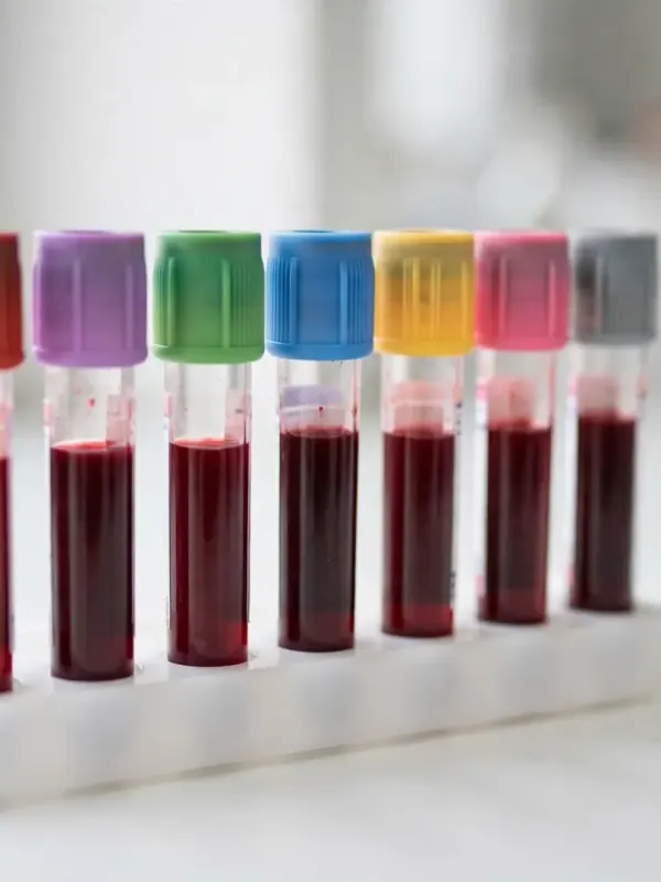 Sample tubes
